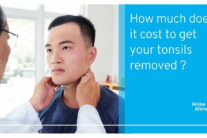 How much does it cost to get your tonsils removed